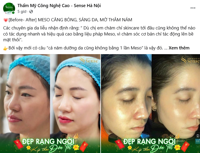 30+ Mẫu content Spa khiến chị em “Đổ xô” đi làm đẹp