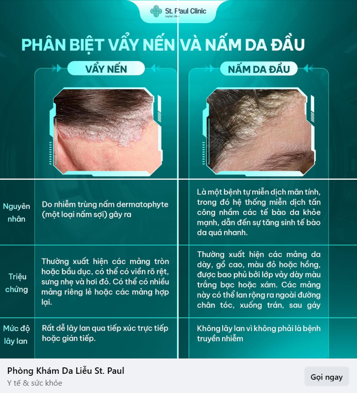60+ Mẫu content quảng cáo phòng khám ấn tượng hút khách 30 Mẫu content quảng cáo phòng khám ấn tượng hút khách