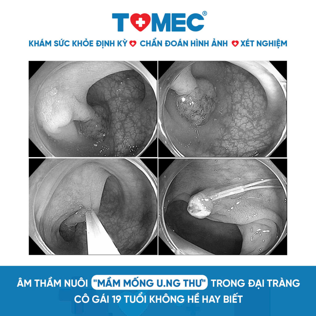 60+ Mẫu content quảng cáo phòng khám ấn tượng hút khách 81 Mẫu content quảng cáo phòng khám ấn tượng hút khách